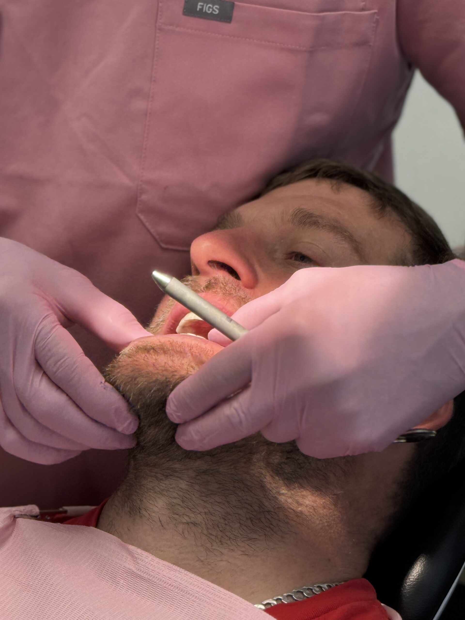 Alveolar stabilization after tooth loss in Laval